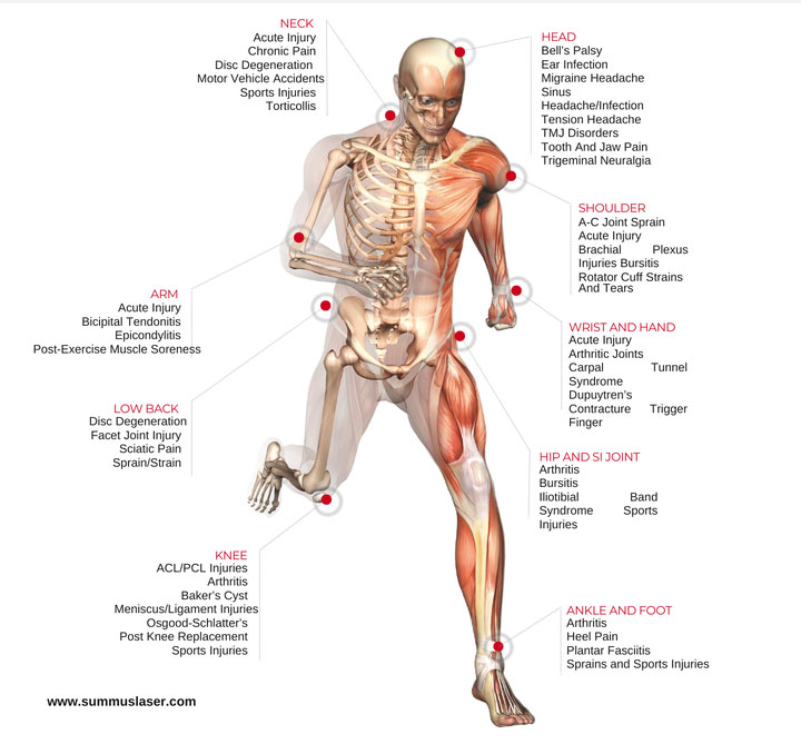Chiropractic Cutlerville MI Body Diagram