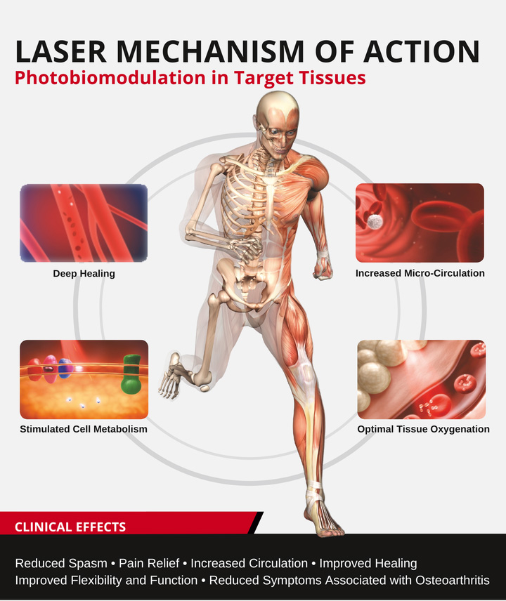 Chiropractic Cutlerville MI Laser Mechanism